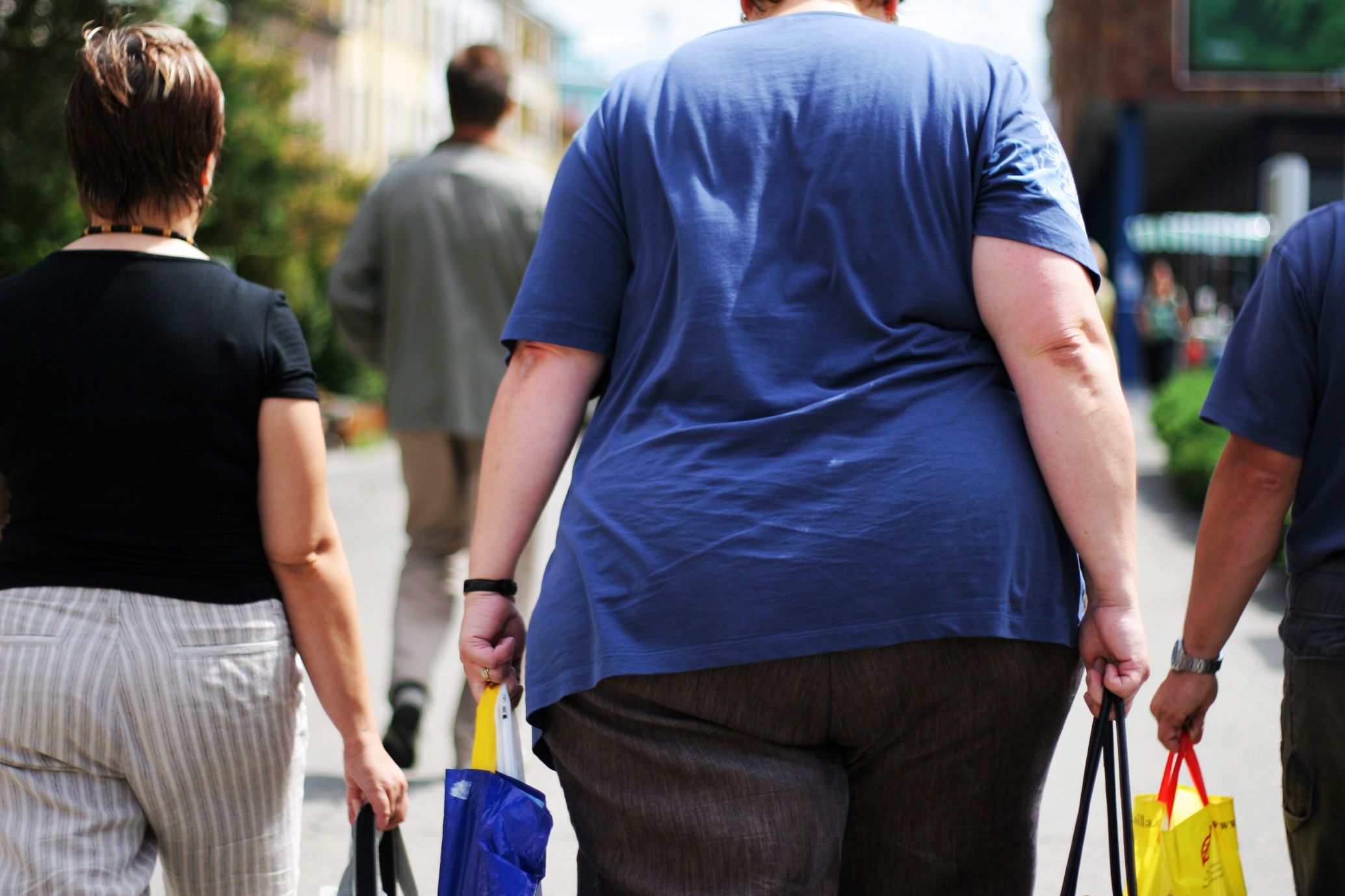 Obezite hastalarına 7 adımda yol haritası
